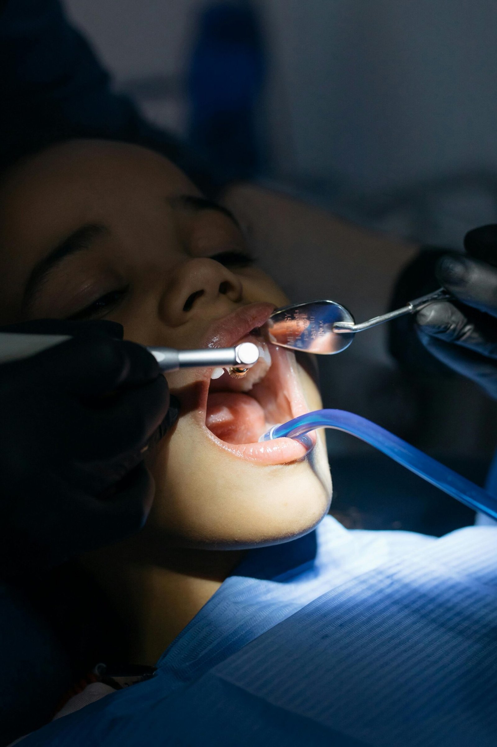 Close-up of a child receiving a dental checkup at a clinic, focusing on oral care.