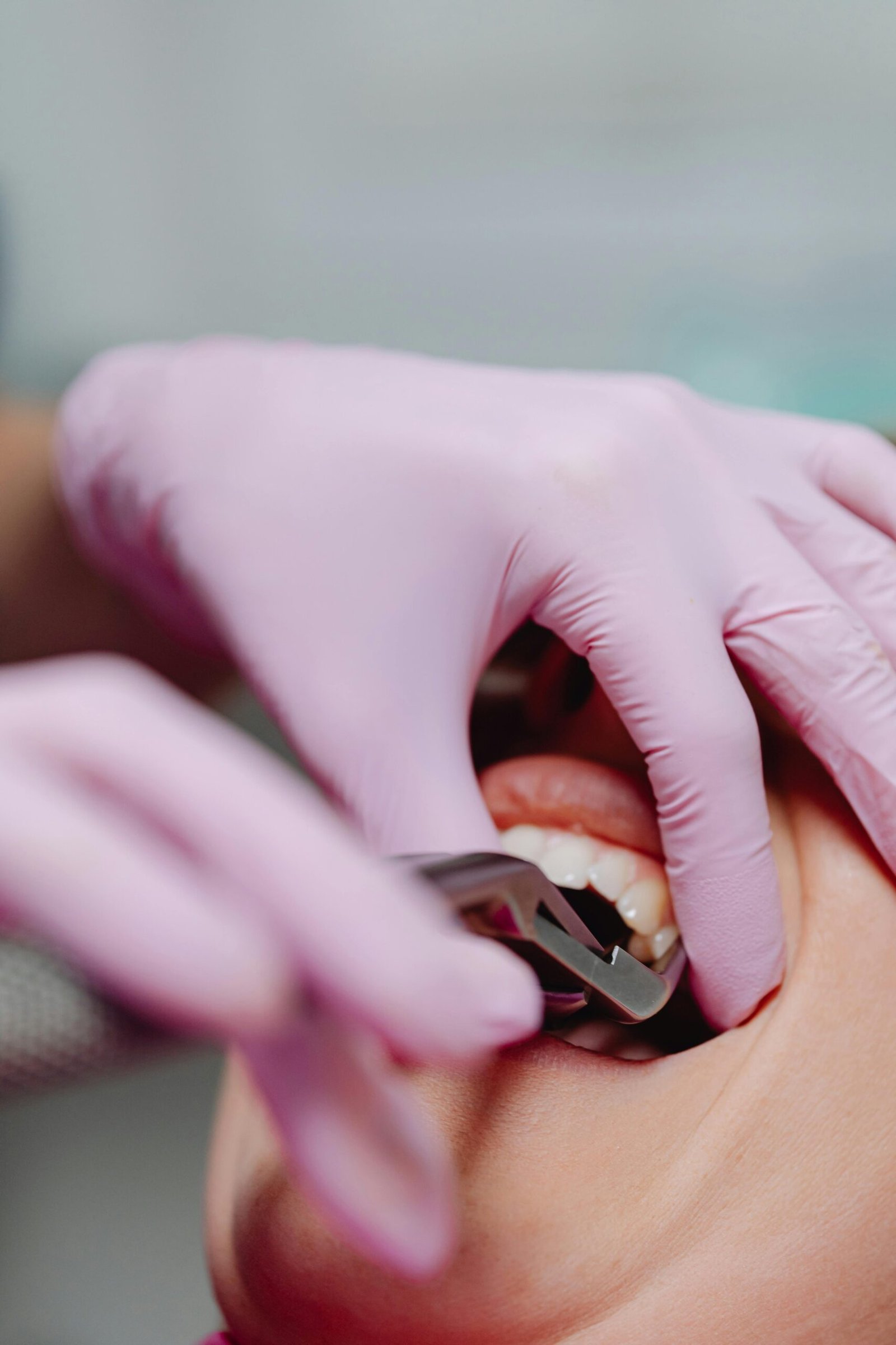 Close-up of dental tools in use during a patient's examination in a dental clinic.