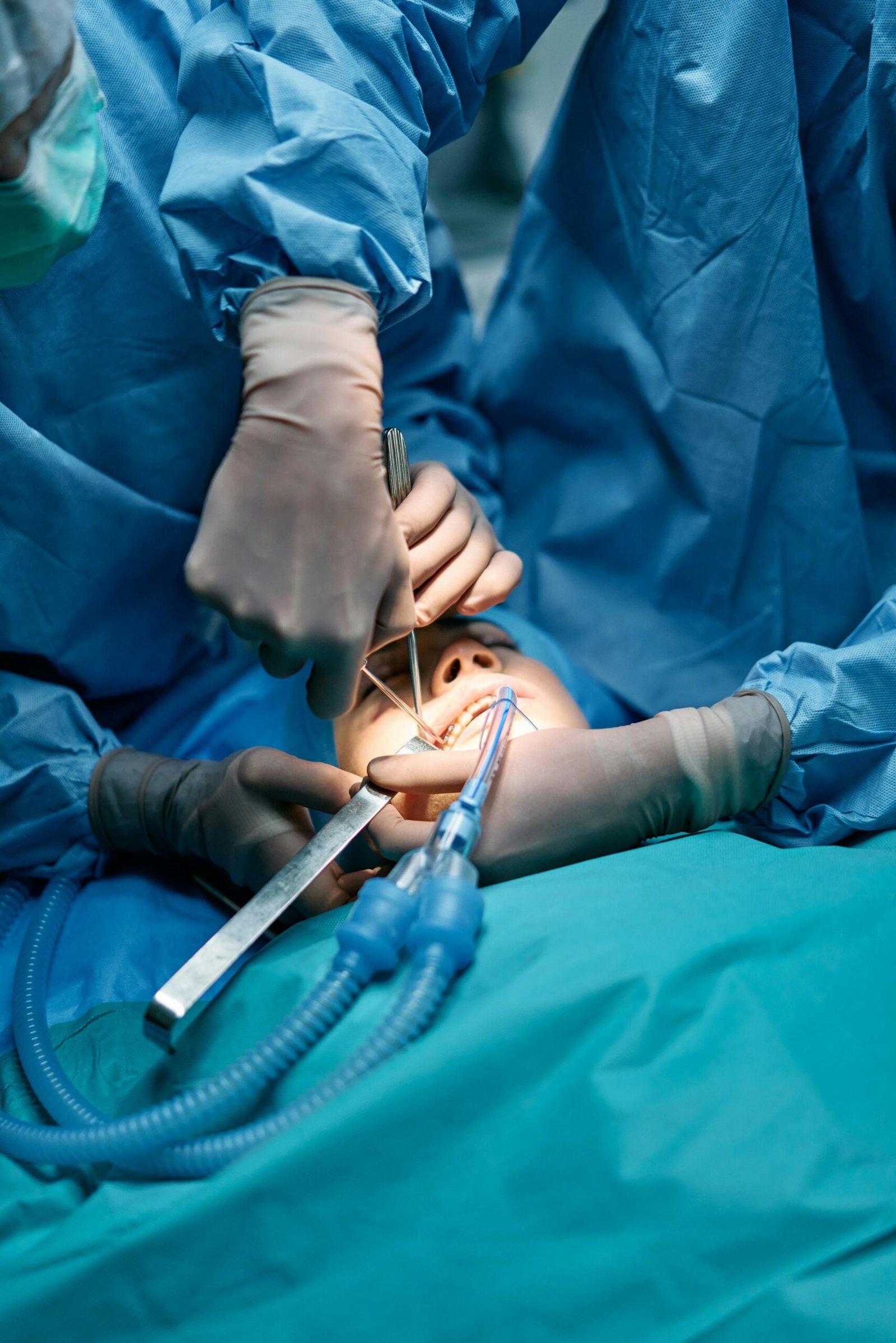 Surgeons performing a detailed surgical operation on a patient under anesthesia in an operating room.